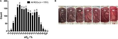 Oxygen in Red Blood Cell Concentrates: Influence of Donors’ Characteristics and Blood Processing